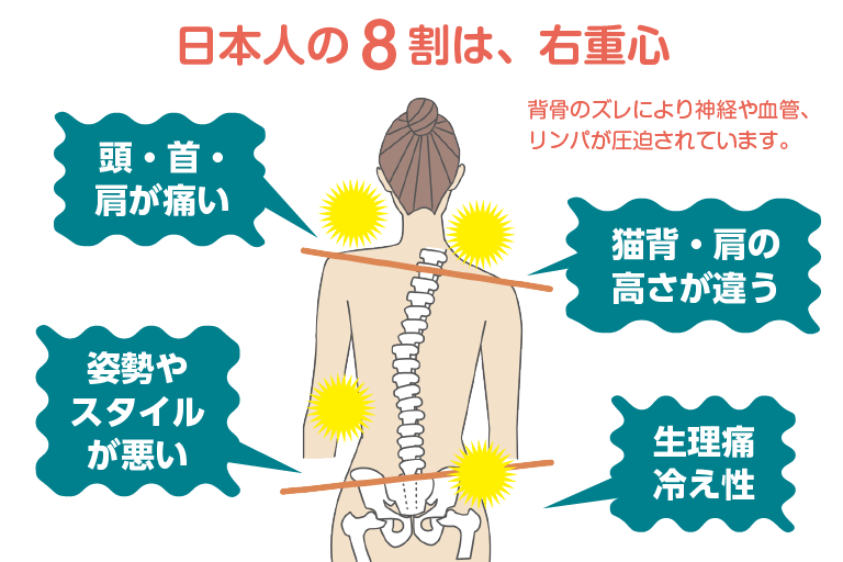 日本人の8わり8割は右重心の図 背骨のズレにより神経や血管、リンパが圧迫されています。 頭・首・肩が痛い 姿勢やスタイルが悪い 猫背・肩の高さが違う 生理痛・冷え性