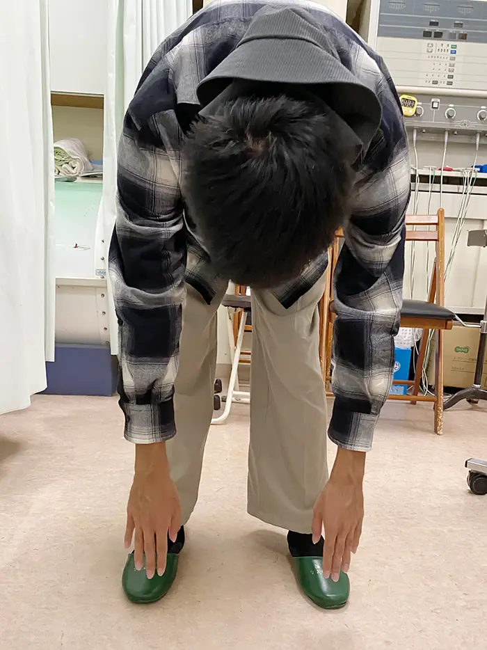 17歳男子学生。体幹矯正施術後、前屈改善。