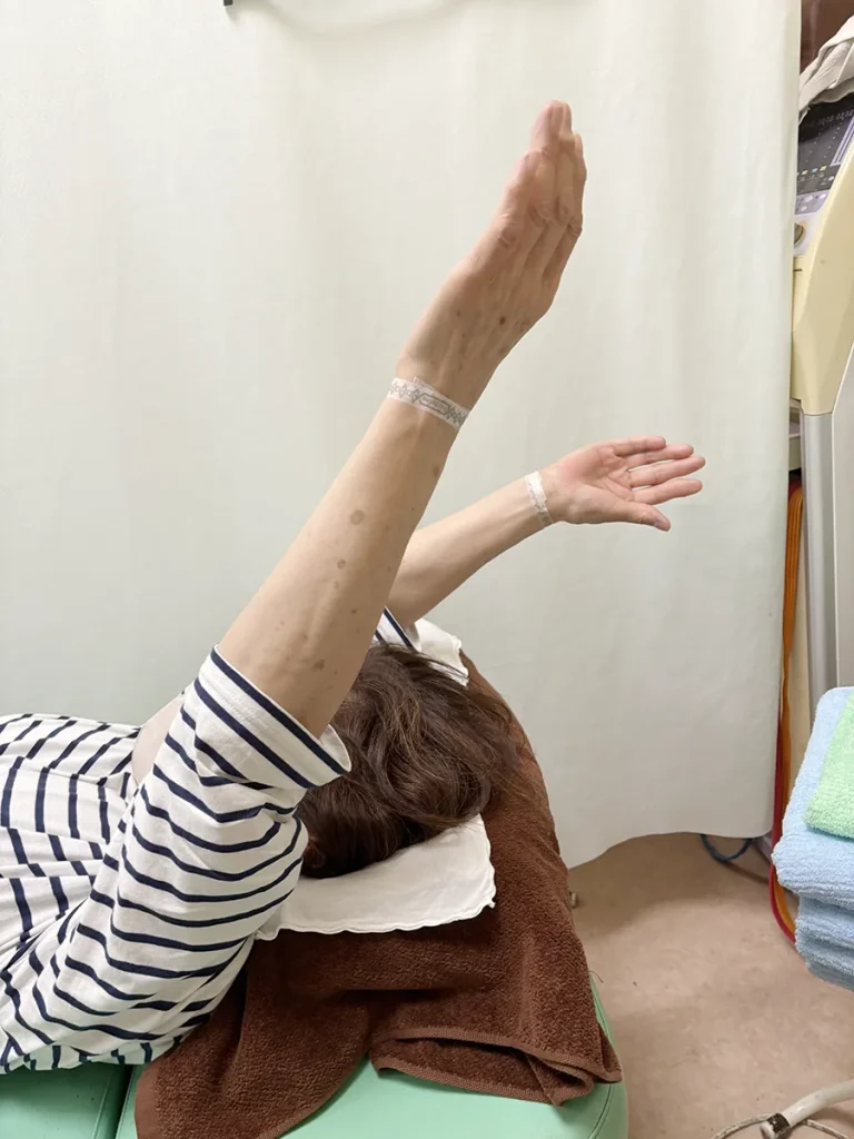 施術前-腕を後ろに反らすことができない