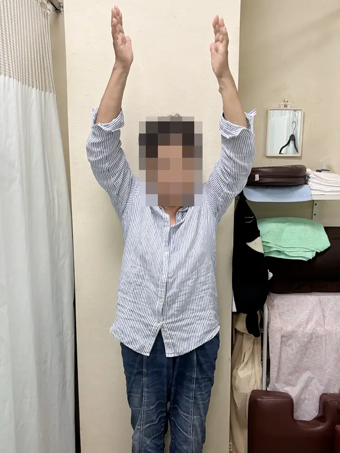 体幹矯正施術後-腕が上がるように