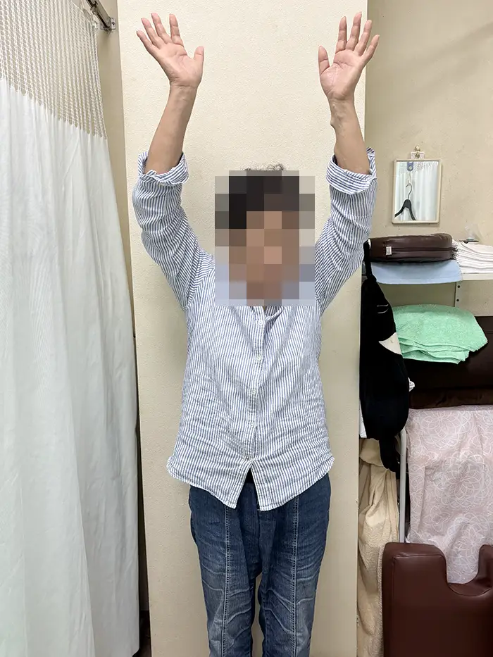 体幹矯正施術前-腕が上がりにくい