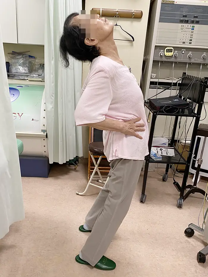施術前、体を反らすことができない