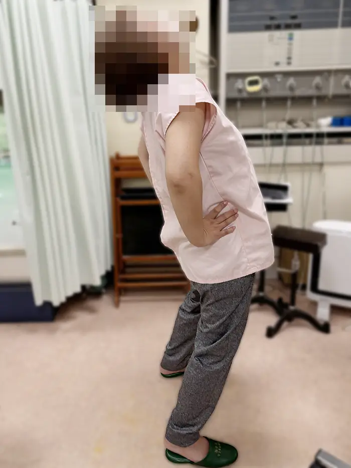 施術前。体が反らすことが困難。
