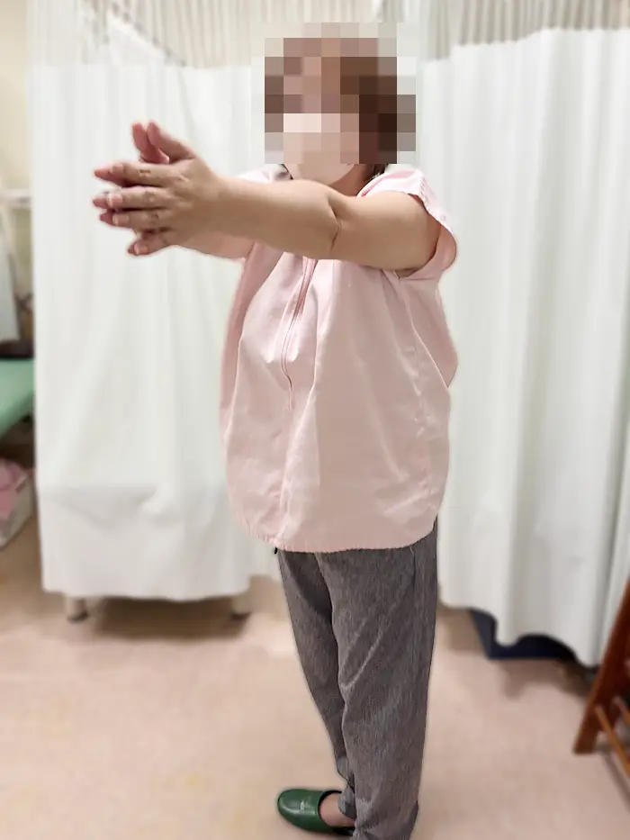 施術前。腰を捻ることができない。