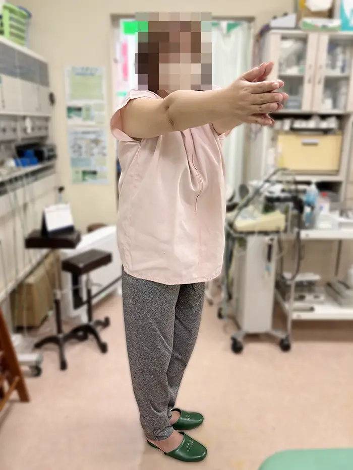 施術前。腰を捻ることができない。