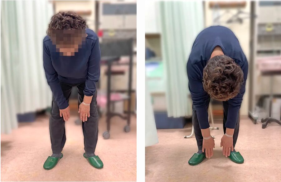 根本整体施術後、腰をかがめやすくなった女性