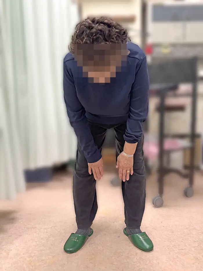 根本整体施術前の女性 腰が曲げられない