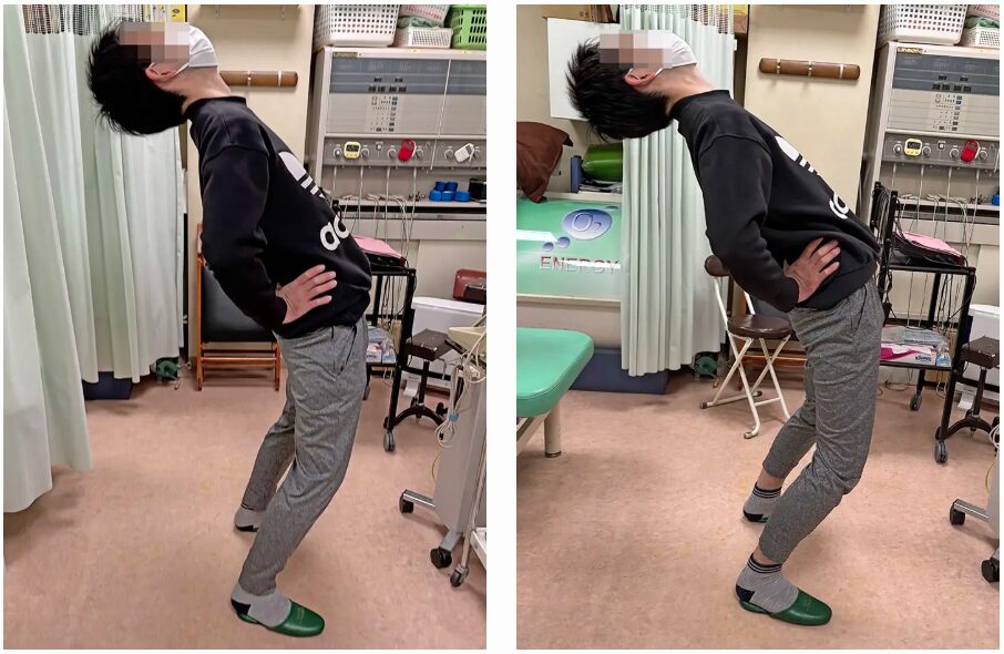 根本整体施術後、腰を反らすことができるようになった男性