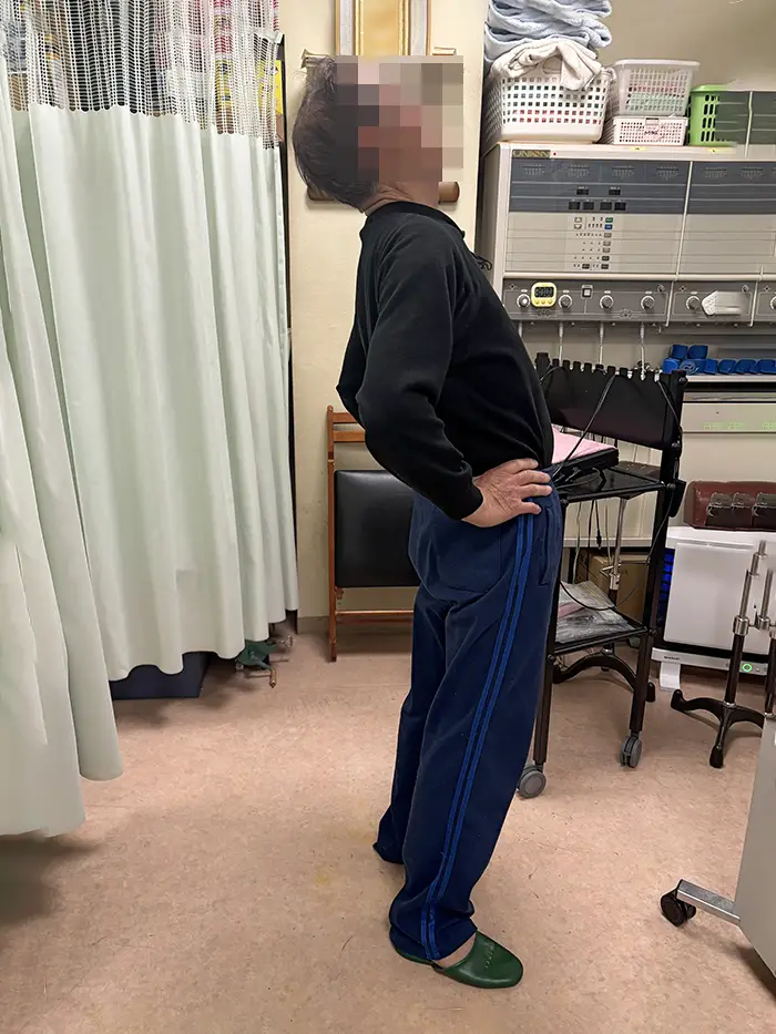 体幹矯正施術前の男性 腰を反らすことができない