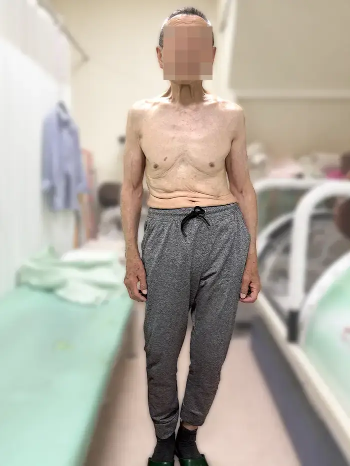根本整体施術後の81歳男性26年8月　重心バランスが整ってきた