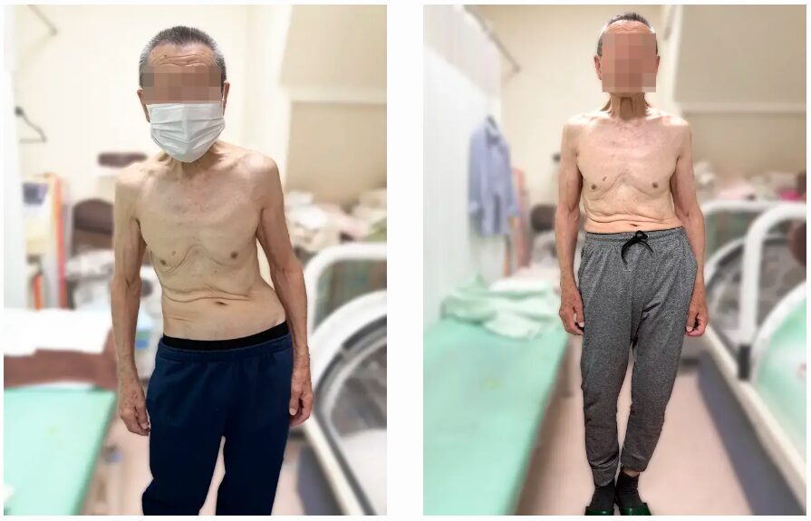 根本整体施術後、身体の重心バランスが整ってきた男性