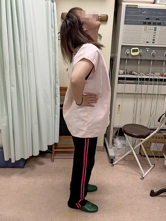 根本整体施術前の女性 腰を反らすことが困難