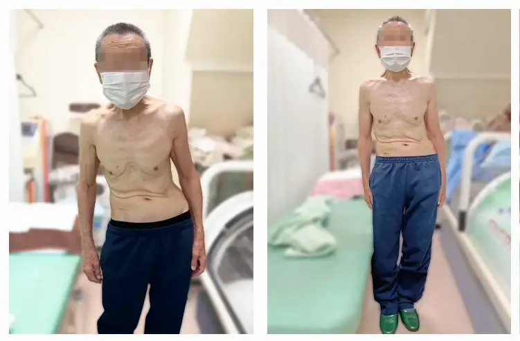 根本整体施術後、身体の重心バランスが整ってきた男性